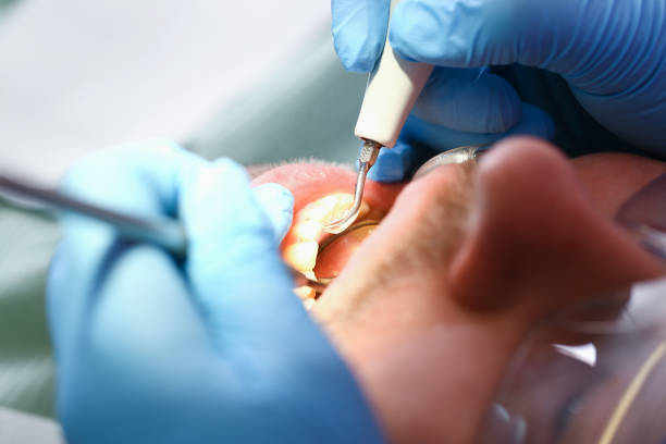 Best 24-Hour Emergency Dental Care in South Run, VA