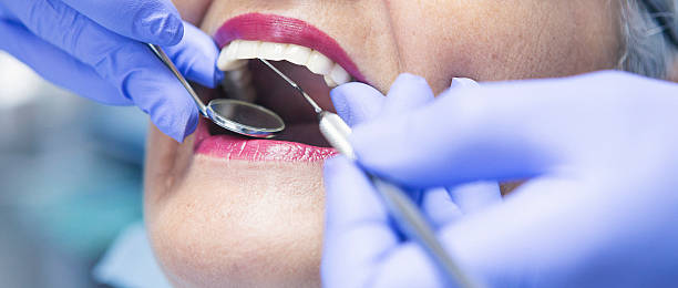 Best Emergency Dental Care for Sports Injuries in South Run, VA